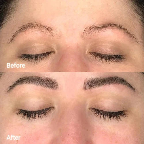 Eyebrow Growth Roller