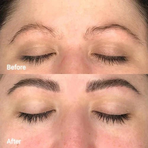 Eyebrow Growth Roller - ZENRELIEF™